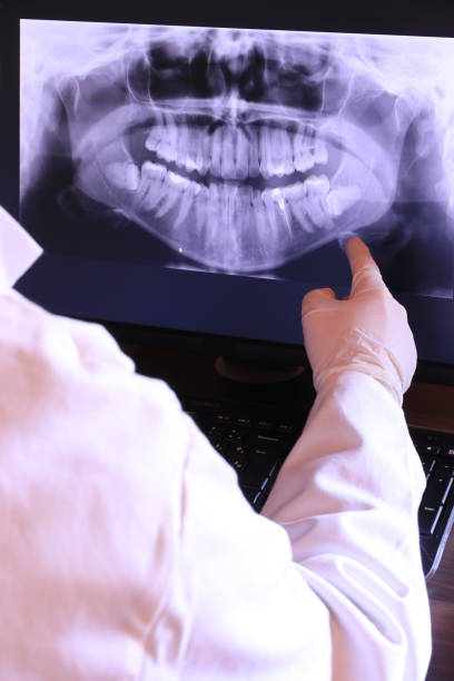 Best Emergency Tooth Extraction in Canterwood, WA